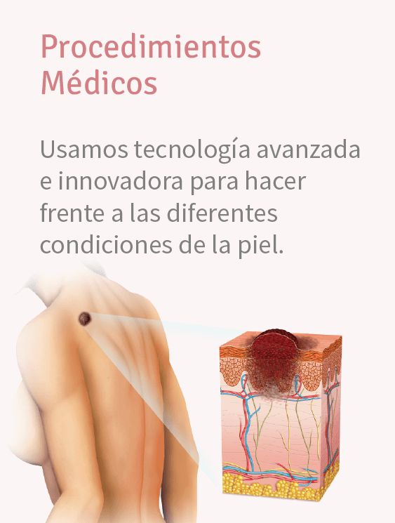 procedimientos medicos dermatologia crioterapia cauterizacion medellin